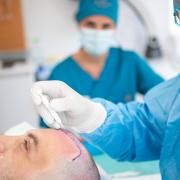 At Seneca Medical Group, hair transplants are performed exclusively by doctors, never by technicians or under supervision